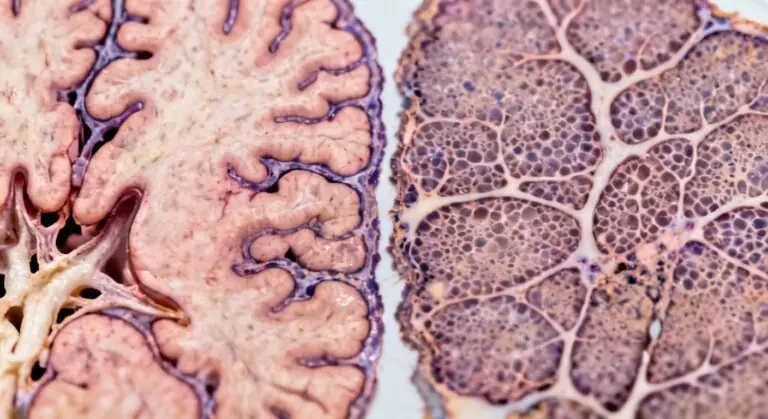 Comprendre pourquoi le cerveau humain met plus de temps à mûrir que celui de nos cousins primates